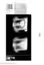 Fig. 34 - Medical scan comparison system