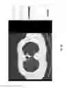 Fig. 41 - Medical scan comparison system