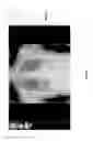 Fig. 43 - Medical scan comparison system