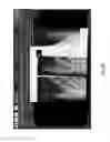 Fig. 52 - Medical scan comparison system