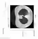 Fig. 54 - Medical scan comparison system