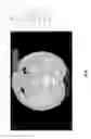 Fig. 22 - Medical scan image analysis system