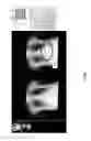 Fig. 34 - Medical scan image analysis system