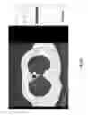 Fig. 41 - Medical scan image analysis system