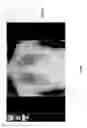 Fig. 43 - Medical scan image analysis system