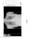 Fig. 44 - Medical scan image analysis system