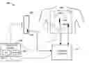 Fig. 01 - Ultrasound-based geometry determination for electrophysiological mapping
