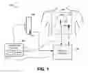Fig. 02 - Ultrasound-based geometry determination for electrophysiological mapping