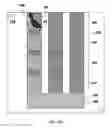 Fig. 40 - Self-scrolling braille