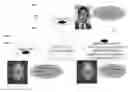 Fig. 01 - System and method for voice-to-voice conversion
