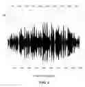Fig. 05 - System and method for voice-to-voice conversion