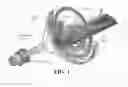Fig. 02 - Dynamic beam aperture control to reduce radiation dose using collimator