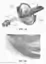 Fig. 06 - Dynamic beam aperture control to reduce radiation dose using collimator