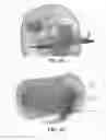 Fig. 09 - Dynamic beam aperture control to reduce radiation dose using collimator