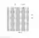 Fig. 04 - OLED DEVICE PACKAGING COMPONENT, PACKAGING METHOD AND DISPLAY DEVICE THEREOF