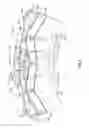 Fig. 08 - Variable flux bridge for rotor an electric machine