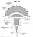 Fig. 07 - Spherical infrared emitter