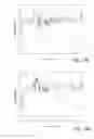 Fig. 13 - Active room compensation in loudspeaker system