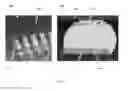 Fig. 16 - Method of supplying electrical power from rigid printed circuit board to another rigid printed circuit board in rigid-flex printed circuit board array