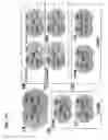 Fig. 02 - Supplementation of milk formulas with microvesicles isolated from milk