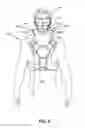 Fig. 06 - Neck protective apparatus and a method of using same