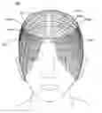 Fig. 01 - Hair addition
