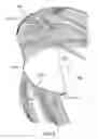 Fig. 09 - Hair addition