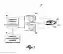 Fig. 03 - Systems and methods for fabricating custom eyelash prostheses
