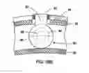 Fig. 08 - SHOCK ABSORBING SYSTEM FOR PROTECTIVE EQUIPMENT AND DEVICES THEREFOR