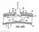 Fig. 10 - SHOCK ABSORBING SYSTEM FOR PROTECTIVE EQUIPMENT AND DEVICES THEREFOR