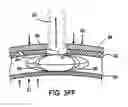 Fig. 12 - SHOCK ABSORBING SYSTEM FOR PROTECTIVE EQUIPMENT AND DEVICES THEREFOR