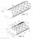 Fig. 06 - Double layer, single tube braid for footwear upper