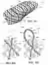 Fig. 07 - Braided articles and methods for their manufacture