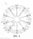 Fig. 04 - Braided articles and methods for their manufacture