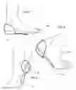 Fig. 04 - INTEGRATED SHOE SUPPORT STRUCTURE COMBINING HEEL COUNTER AND SHANK