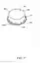 Fig. 08 - Spoutless drinking cup