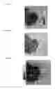Fig. 35 - Optical coherence tomography angiography methods