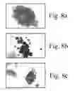 Fig. 09 - METHOD AND APPARATUS FOR ENDOMETRIAL SCREENING