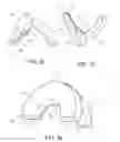 Fig. 04 - Mechanical gun-type circumcision device with glans protection system for safe cutting and cauterization of the foreskin