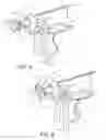 Fig. 06 - Mechanical gun-type circumcision device with glans protection system for safe cutting and cauterization of the foreskin