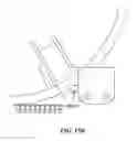 Fig. 16 - Pixel array medical systems, devices and methods