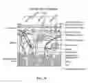 Fig. 35 - Pixel array medical systems, devices and methods