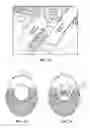 Fig. 40 - Pixel array medical systems, devices and methods