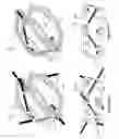 Fig. 33 - External bone fixation systems