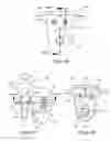 Fig. 76 - External bone fixation systems
