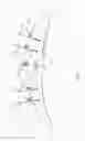Fig. 08 - External fixator assembly