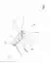 Fig. 02 - Device for reconstructing a spinous process and spinal fixing equipment comprising said device