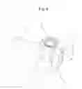 Fig. 07 - Device for reconstructing a spinous process and spinal fixing equipment comprising said device