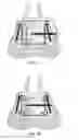 Fig. 06 - Expandable osseointegration bone fixation apparatus for use in a variety of settings