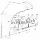 Fig. 01 - Bone fixation implants and methods